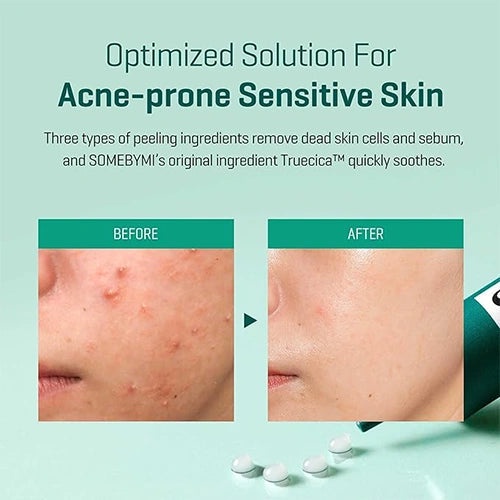 Some By Mi - AHA BHA PHA 14 Days Super Miracle Spot Kill Cream 30ml