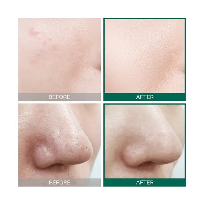 Some By Mi AHA. BHA. PHA 30 Days Miracle Toner 150ml