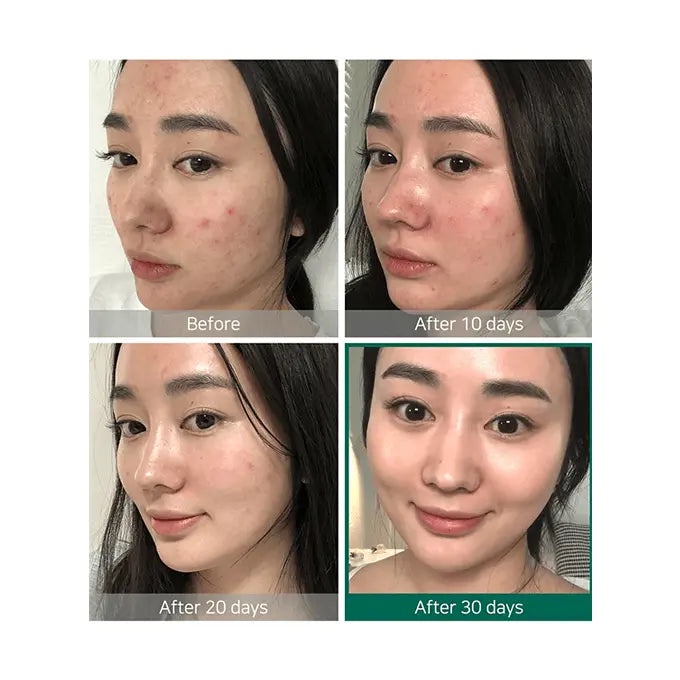 Some By Mi AHA. BHA. PHA 30 Days Miracle Toner 150ml